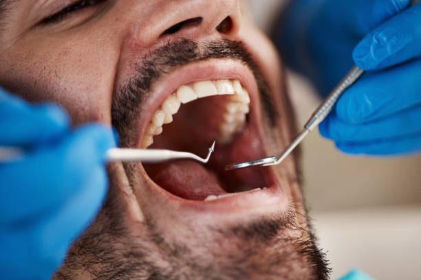 Best Pediatric Emergency Dentist in Choctaw Lake, OH